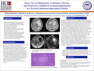 Rare Case of Multicentric Castleman's Disease and Progressive Multifocal Leukoencephalopathy