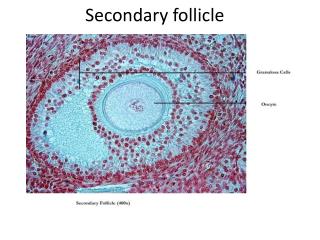 Secondary follicle