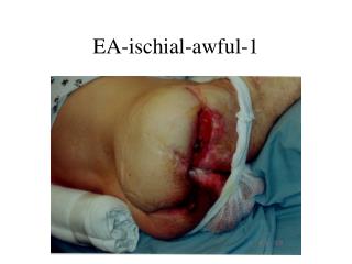 EA-ischial-awful-1