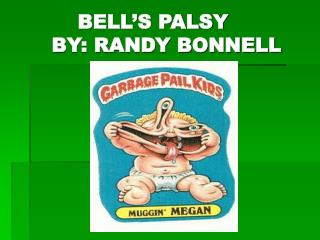 BELL’S PALSY BY: RANDY BONNELL