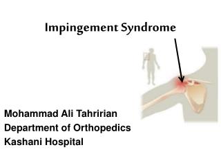 Impingement Syndrome