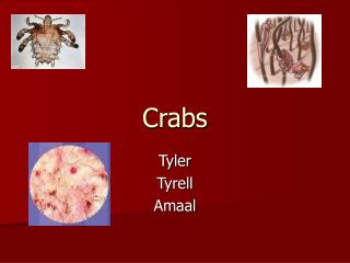 Crabs