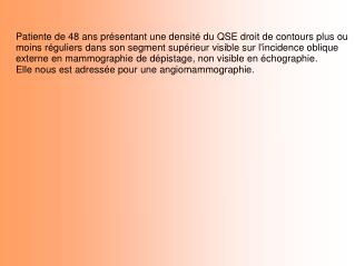 Patiente de 48 ans présentant une densité du QSE droit de contours plus ou