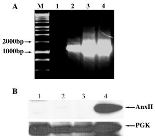 AnxII