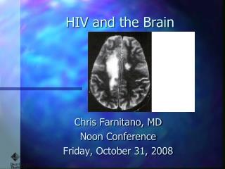 HIV and the Brain