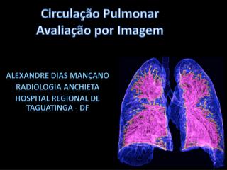 Circulação Pulmonar Avaliação por Imagem