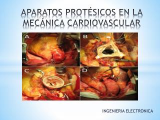 APARATOS PROTÉSICOS EN LA MECÁNICA CARDIOVASCULAR