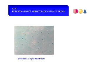 Spermatozoi ad ingrandimento 400x