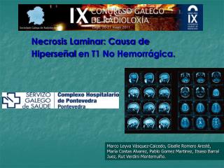 Necrosis Laminar: Causa de Hiperseñal en T1 No Hemorrágica.