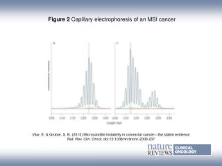 Figure 2 Capillary electrophoresis of an MSI cancer