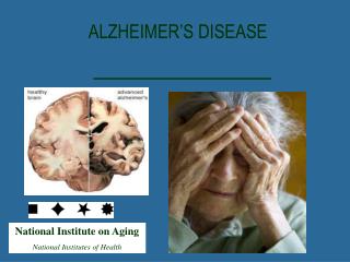 National Institute on Aging National Institutes of Health