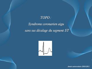 TOPO : Syndrome coronarien aigu