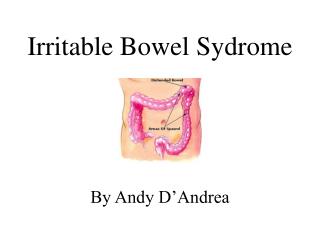 Irritable Bowel Sydrome