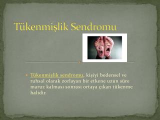 Tükenmişlik Sendromu