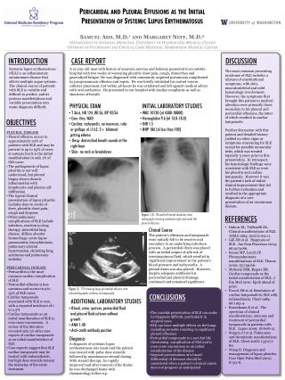 Pericaridal and Pleural Effusions as the Initial Presentation of Systemic Lupus Erythematosus