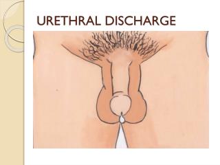 URETHRAL DISCHARGE