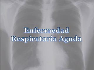 Enfermedad Respiratoria Aguda