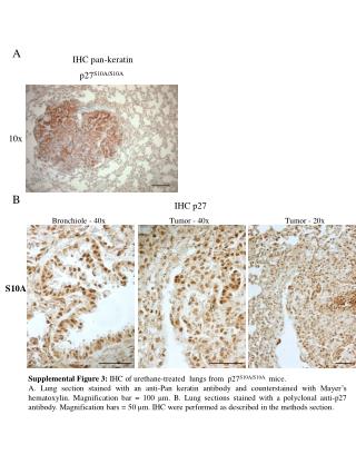 Supplemental Figure 3: IHC of urethane-treated lungs from p27 S10A/S10A mice.