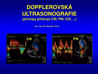 DOPPLEROVSKÁ ULTRASONOGRAFIE (principy přístrojů CW, PW, CDI, ...)