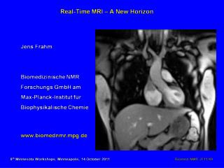Real-Time MRI – Outline