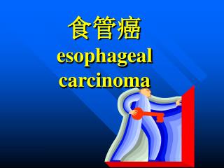 食管癌 esophageal carcinoma