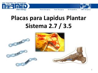 Placas para Lapidus Plantar Sistema 2.7 / 3.5