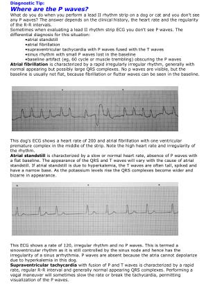 Diagnostic Tip: Where are the P waves?