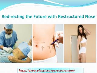 Redirecting the Future with Restructured Nose