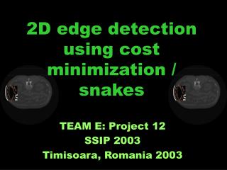 2D edge detection using cost minimization / snakes