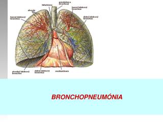 BRONCHOPNEUMÓNIA