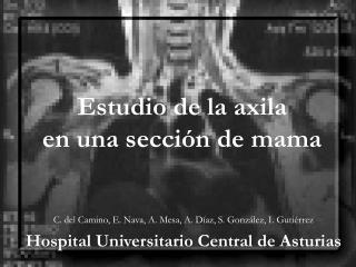 Estudio de la axila en una sección de mama