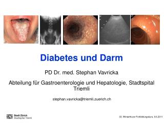 Diabetes und Darm PD Dr. med. Stephan Vavricka