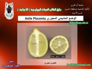 الوضع المشيمي المحوري Axile Placenta