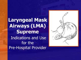 Laryngeal Mask Airways (LMA) Supreme Indications and Use for the Pre-Hospital Provider