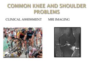 COMMON KNEE AND SHOULDER PROBLEMS