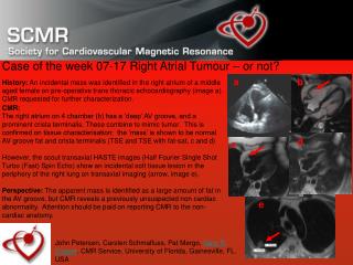 Case of the week 07-17 Right Atrial Tumour – or not?