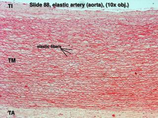 Slide 88, elastic artery (aorta), (10x obj.)