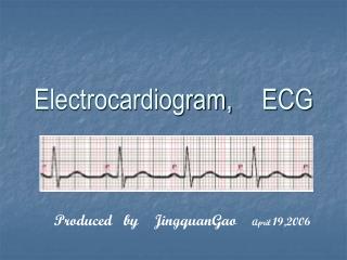 Electrocardiogram, ECG