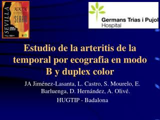Estudio de la arteritis de la temporal por ecografia en modo B y duplex color