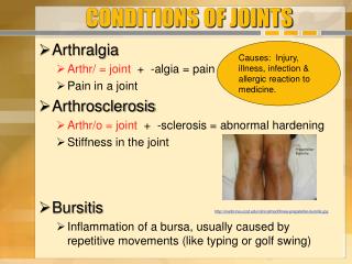 CONDITIONS OF JOINTS