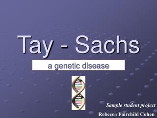Tay - Sachs