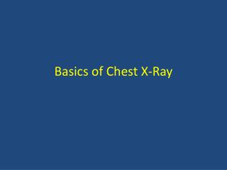 Basics of Chest X-Ray