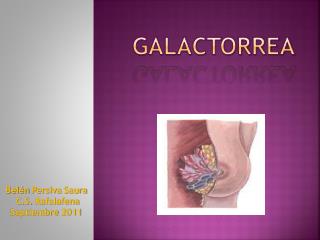 GALACTORREA