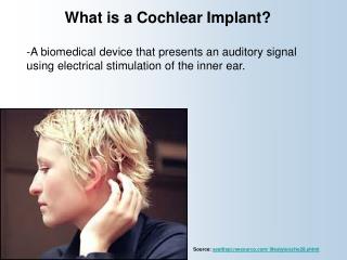 What is a Cochlear Implant?