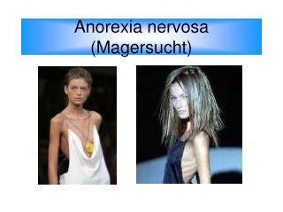 Anorexia nervosa (Magersucht)