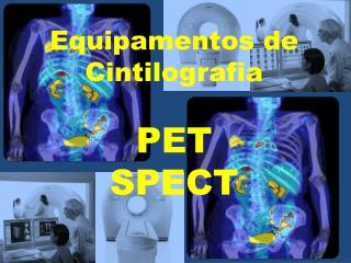 Equipamentos de Cintilografia PET SPECT
