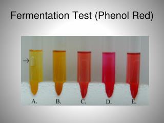 Fermentation Test (Phenol Red)