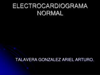 ELECTROCARDIOGRAMA NORMAL