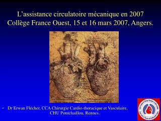 L’assistance circulatoire mécanique en 2007 Collège France Ouest, 15 et 16 mars 2007, Angers.
