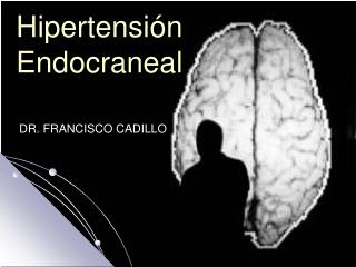 Hipertensión Endocraneal